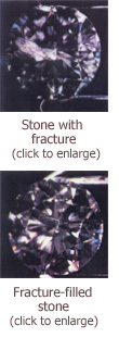 before and after fracture filling